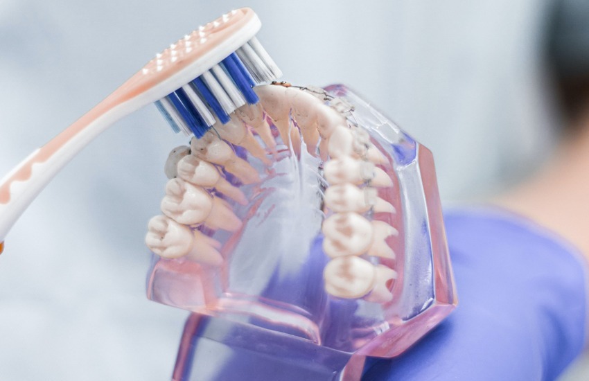 Higiene en el postoperatorio de un implante dental
