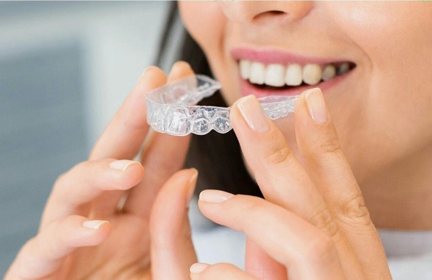 Tratamiento de ortodoncia con alineadores invisibles