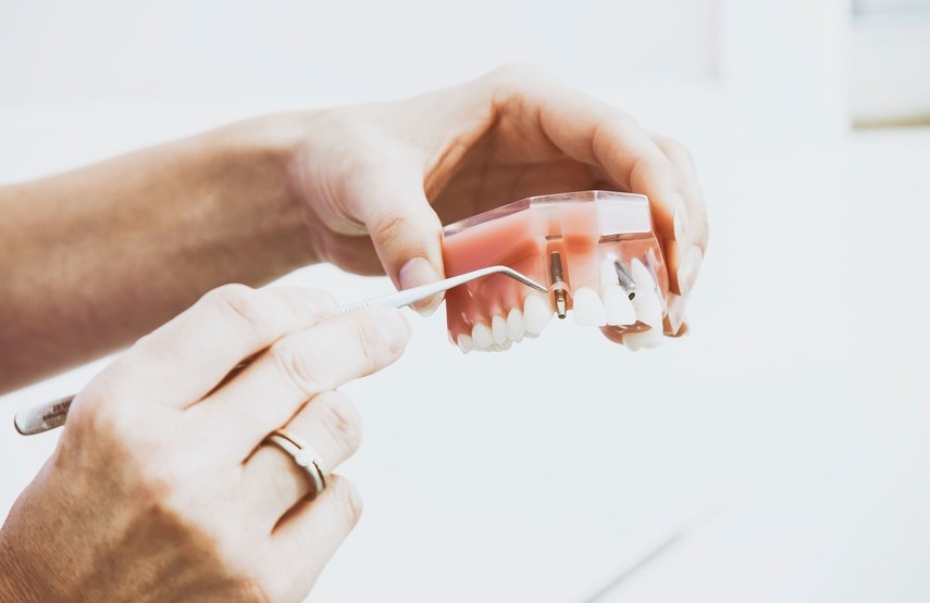 El implante dental se mueve