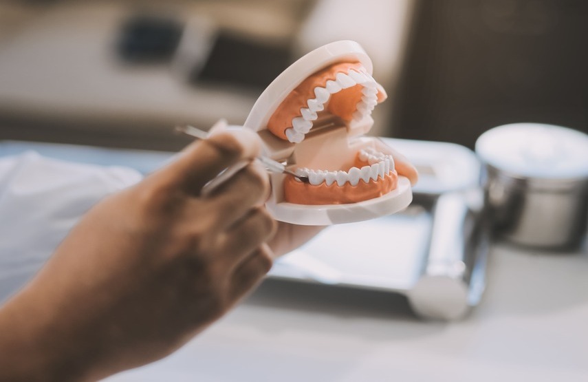 Colocación de microtornillos de ortodoncia