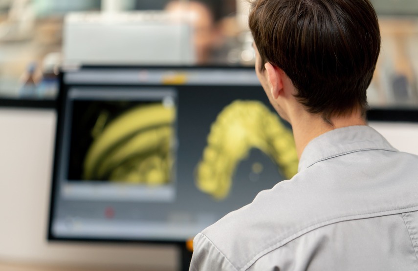 Escáner intraoral en 3D