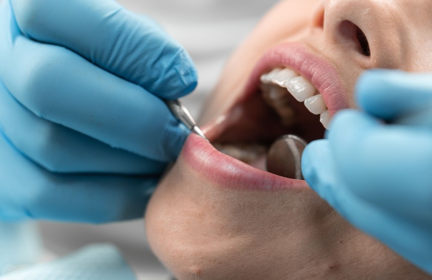 Consulta por inflamación de encías