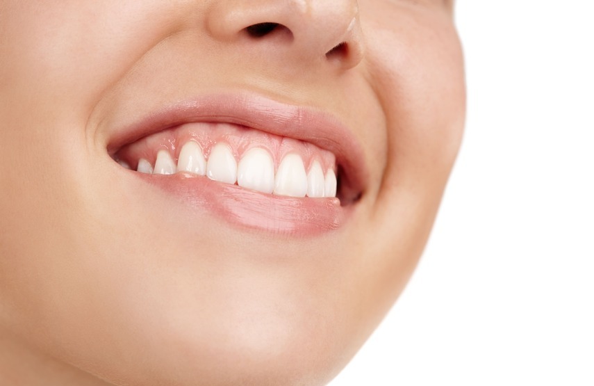 ¿Qué es la gingivoplastia?