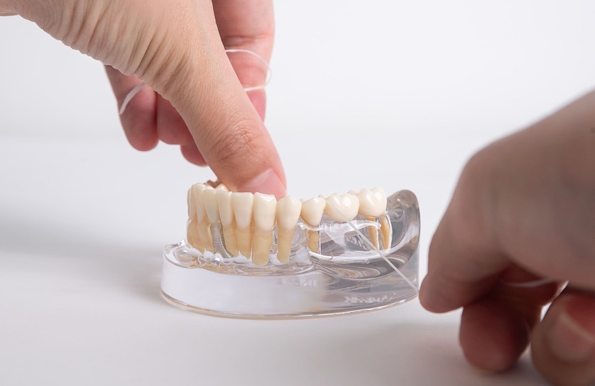 ¿Cuáles son los síntomas de rechazo de un implante dental?